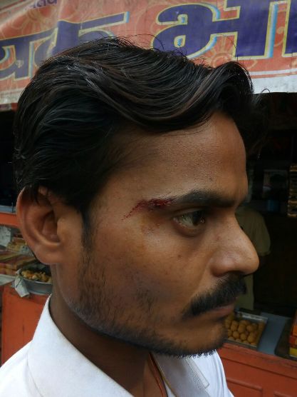 कानपुर घंटाघर चौराहे पर ट्रैफिक सिपाही ने युवक के सिर में मारा डंडा