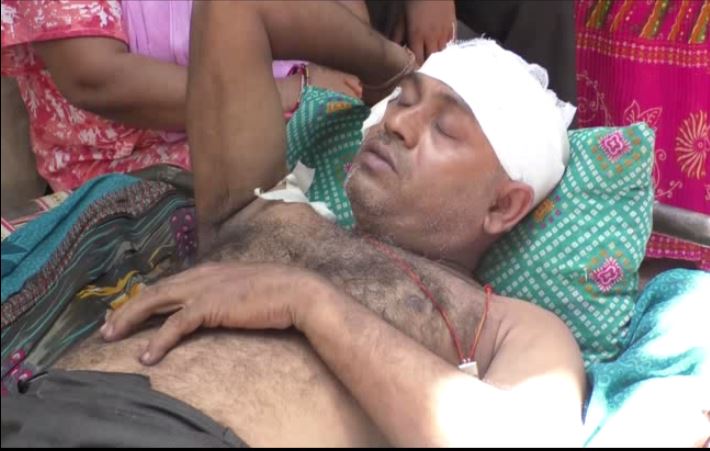 कानपुर- पेड़ की डाल गिरने से व्यक्ति बुरी तरह से हुआ घायल