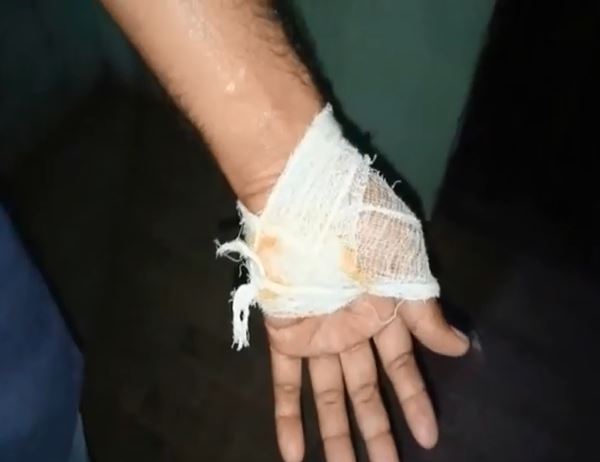औरैया में पत्रकारों पर हुआ कायराना हमला